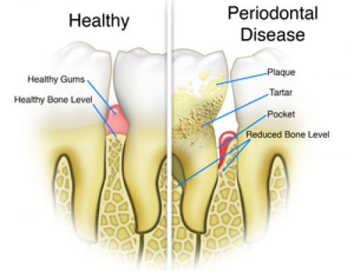 Healthy Gums, Healthy You!